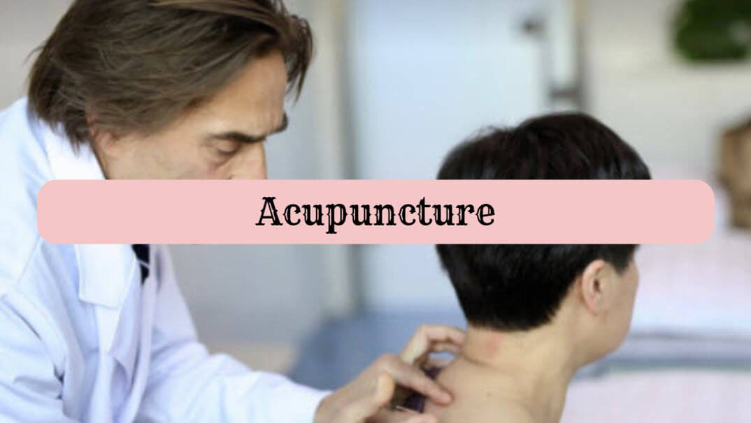 acupuncture